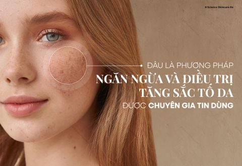 Đâu Là Phương Pháp Ngăn Ngừa Và Điều Trị Tăng Sắc Tố Da Được Chuyên Gia Tin Dùng?