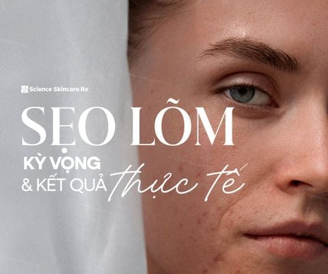 SẸO LÕM: KỲ VỌNG & ĐÁP ỨNG THỰC TẾ – NHỮNG ĐIỀU CẦN BIẾT TRƯỚC KHI ĐIỀU TRỊ
